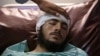 An injured man receives medical treatment at a hospital in Peshawar on July 31.