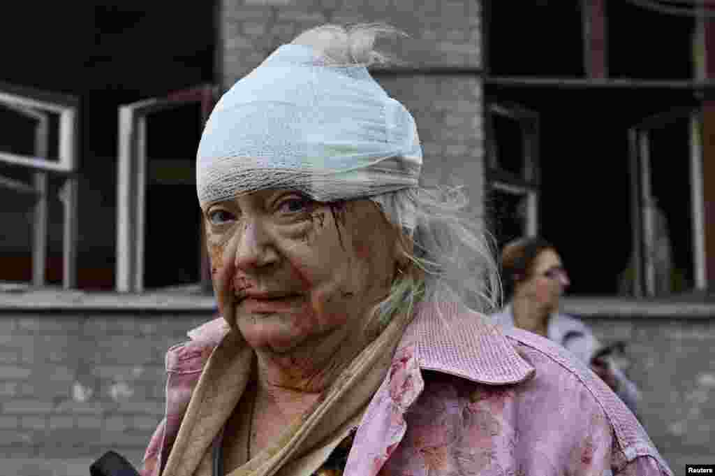 A wounded resident is seen after the September 29 attacks.