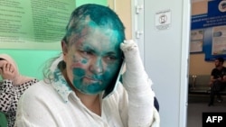 The attackers shaved Yelena Milashina's head, broke several of her fingers, and covered her head with green dye.