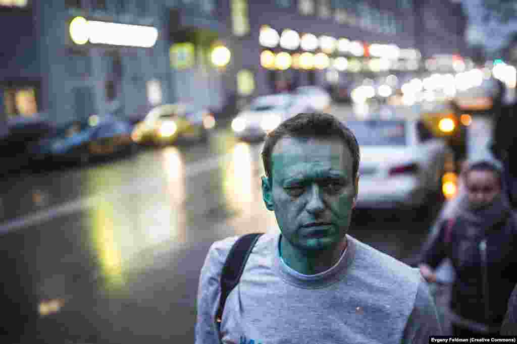 Navalny on his way to the hospital after being splashed with green dye by unknown assailants in Moscow in April 2017. He suffered burns to his eye in the attack.