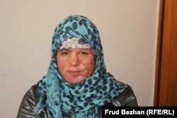 An 18-year-old survivor of domestic abuse who was one of hundreds of Afghan girls and women who found refuge in shelters in the previous decade. (file photo)