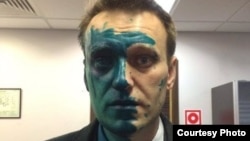 Aleksei Navalny said that his vision in the eye was still considerably impaired after surgery and that it could take several months for it to be restored.